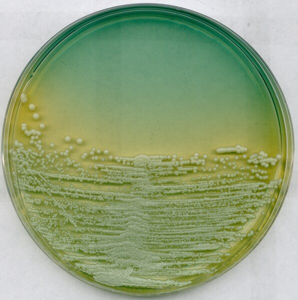 WL nutrient agar | 110866